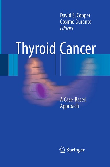 David S. Cooper, Cosimo Durante - Thyroid Cancer, Häftad
