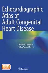 bokomslag Echocardiographic Atlas of Adult Congenital Heart Disease