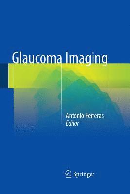 bokomslag Glaucoma Imaging