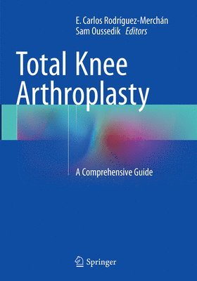 bokomslag Total Knee Arthroplasty