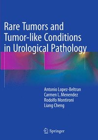 bokomslag Rare Tumors and Tumor-like Conditions in Urological Pathology
