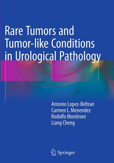 Antonio Lopez-Beltran, Carmen L. Menendez, Rodolfo Montironi, Liang Cheng - Rare Tumors and Tumor-like Conditions in Urological Pathology, Häftad