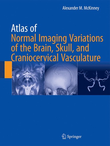 bokomslag Atlas of Normal Imaging Variations of the Brain, Skull, and Craniocervical Vasculature