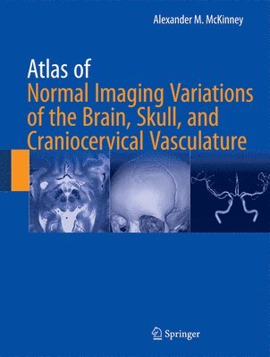 Atlas of Normal Imaging Variations of the Brain, Skull, and Craniocervical Vasculature 1