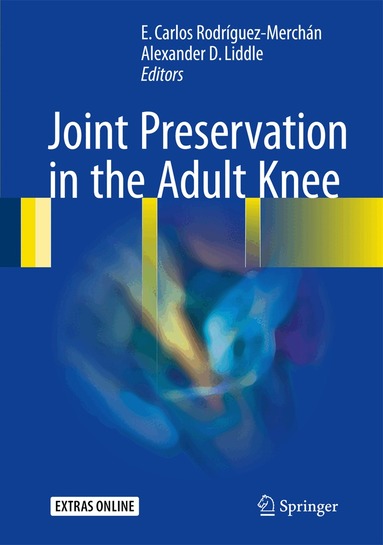 E. Carlos Rodríguez-Merchán, Alexander D. Liddle - Joint Preservation in the Adult Knee, Inbunden
