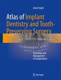 bokomslag Atlas of Implant Dentistry and Tooth-Preserving Surgery