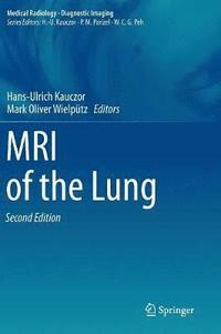 bokomslag MRI of the Lung