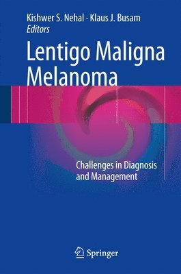 Lentigo Maligna Melanoma