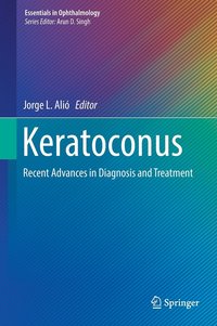 bokomslag Keratoconus