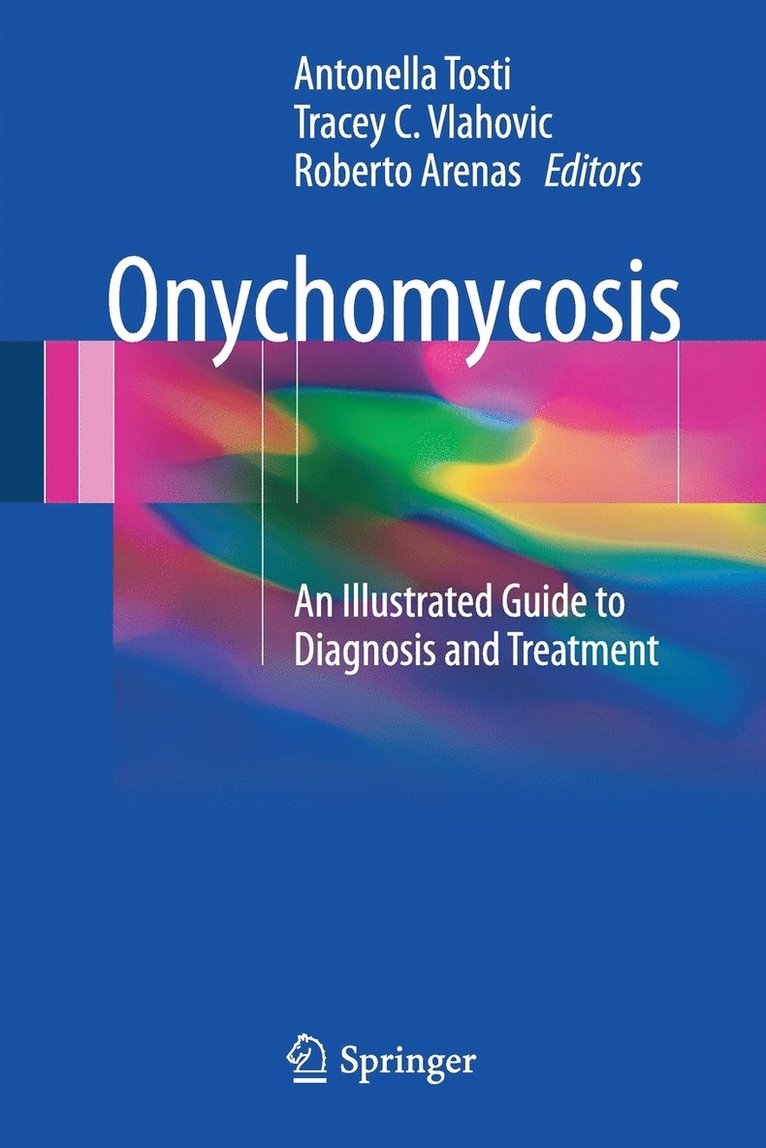 Onychomycosis 1