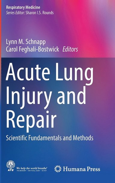 bokomslag Acute Lung Injury and Repair