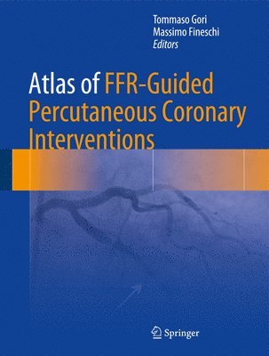 bokomslag Atlas of FFR-Guided Percutaneous Coronary Interventions