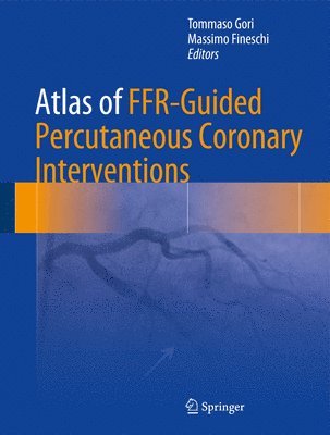 Tommaso Gori, Massimo Fineschi - Atlas of FFR-Guided Percutaneous Coronary Interventions, Inbunden