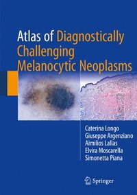bokomslag Atlas of Diagnostically Challenging Melanocytic Neoplasms