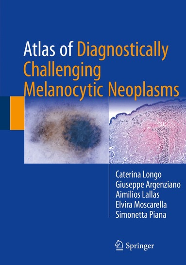 Caterina Longo, Giuseppe Argenziano, Aimilios Lallas, Elvira Moscarella, Simonetta Piana - Atlas of Diagnostically Challenging Melanocytic Neoplasms, Inbunden