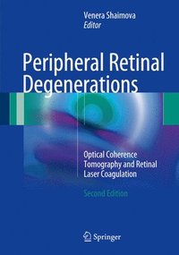 bokomslag Peripheral Retinal Degenerations