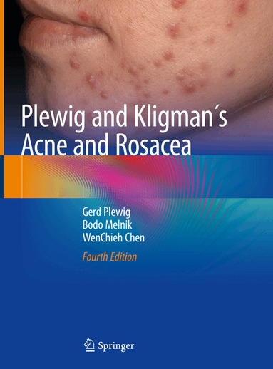 Gerd Plewig, Bodo Melnik, WenChieh Chen - Plewig and Kligman´s Acne and Rosacea, Inbunden