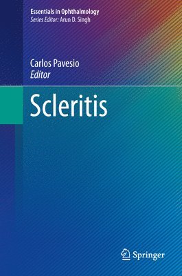 Scleritis 1
