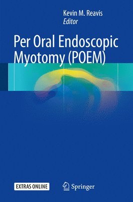 Per Oral Endoscopic Myotomy (POEM) 1