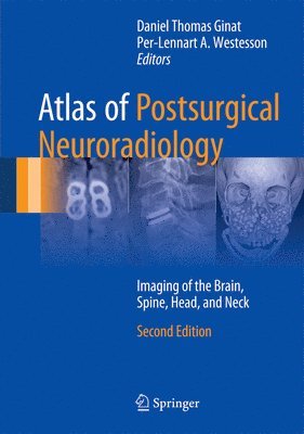 bokomslag Atlas of Postsurgical Neuroradiology