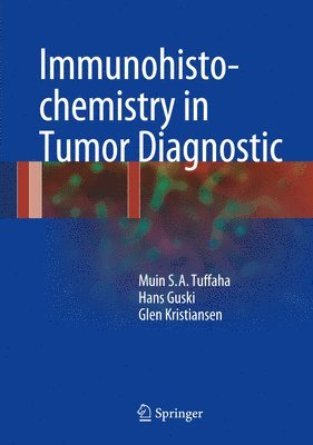 Immunohistochemistry in Tumor Diagnostics