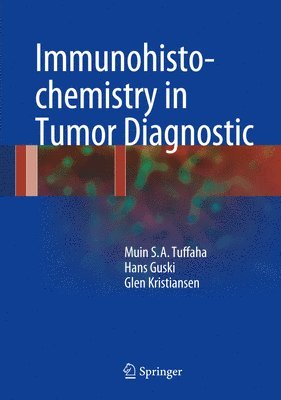 Immunohistochemistry in Tumor Diagnostics 1