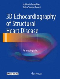 bokomslag 3D Echocardiography of Structural Heart Disease