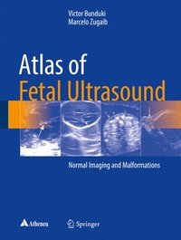 bokomslag Atlas of Fetal Ultrasound