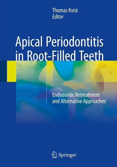 Thomas Kvist - Apical Periodontitis in Root-Filled Teeth, Inbunden