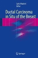 bokomslag Ductal Carcinoma in Situ of the Breast