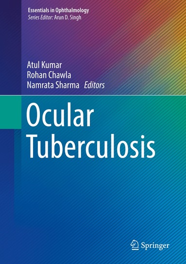 Atul Kumar, Rohan Chawla, Namrata Sharma - Ocular Tuberculosis, Inbunden