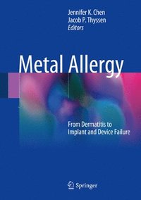 bokomslag Metal Allergy