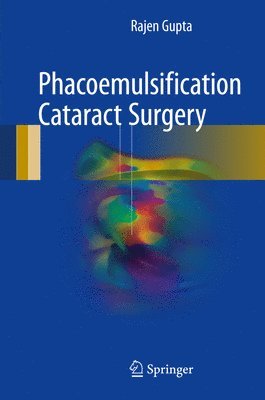 Phacoemulsification Cataract Surgery