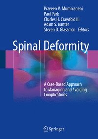 bokomslag Spinal Deformity