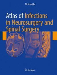 bokomslag Atlas of Infections in Neurosurgery and Spinal Surgery