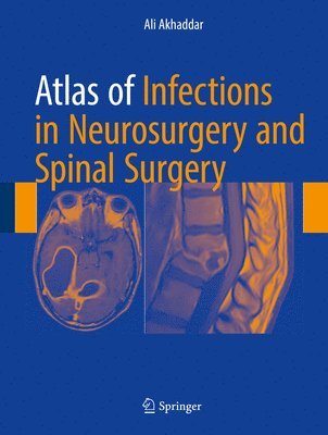 Atlas of Infections in Neurosurgery and Spinal Surgery 1