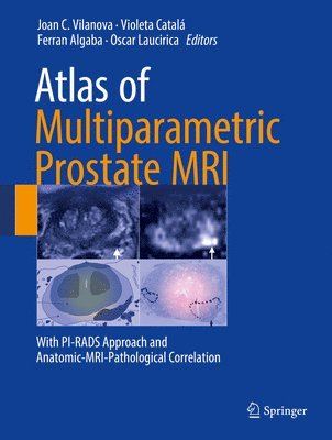 Atlas of Multiparametric Prostate MRI 1