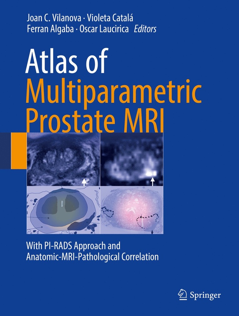 Joan C. Vilanova, Violeta Catala, Ferran Algaba, Oscar Laucirica, Violeta Catalá - Atlas of Multiparametric Prostate MRI, Inbunden