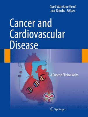 bokomslag Cancer and Cardiovascular Disease