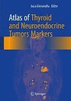 bokomslag Atlas of Thyroid and Neuroendocrine Tumor Markers