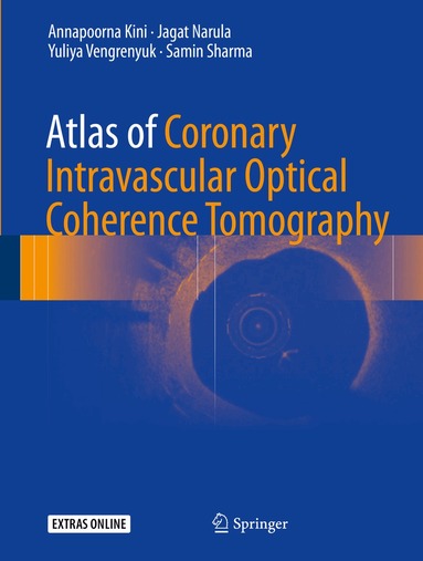 Annapoorna Kini, Jagat Narula, Yuliya Vengrenyuk, Samin Sharma - Atlas of Coronary Intravascular Optical Coherence Tomography, Inbunden