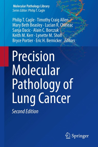 Eric Bernicker, Philip T. Cagle, Timothy Craig Allen, Mary Beth Beasley, Lucian R. Chirieac, Sanja Dacic, Alain C. Borczuk, Keith M. Kerr, Lynette M. Sholl, Bryce Portier, Philip T. Cagle, Timothy Craig Allen, Mary Beth Beasley, Lucian R. Chirieac, Sanja Dacic, Alain C. Borczuk, Keith M. Kerr, Lynette M. Sholl, Bryce Portier, Eric H. Bernicker - Precision Molecular Pathology of Lung Cancer, Inbunden
