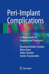 bokomslag Peri-Implant Complications