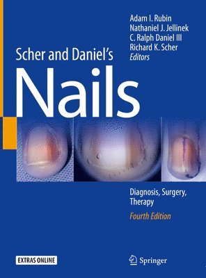 Scher and Daniel's Nails 1