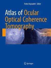 bokomslag Atlas of Ocular Optical Coherence Tomography