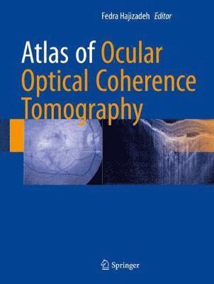 Atlas of Ocular Optical Coherence Tomography 1