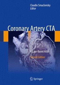 bokomslag Coronary Artery CTA
