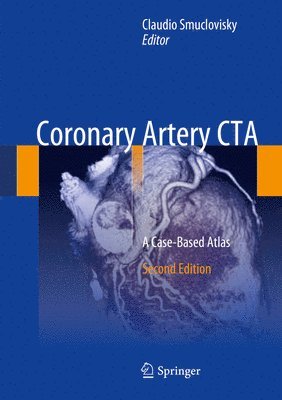 bokomslag Coronary Artery CTA