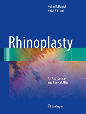 Rhinoplasty 1