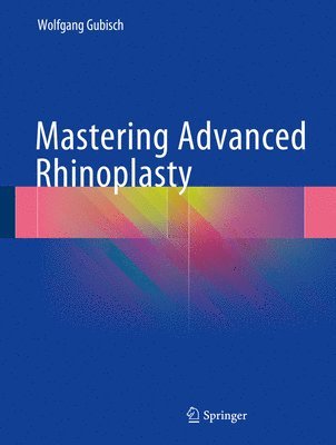 Mastering Advanced Rhinoplasty 1